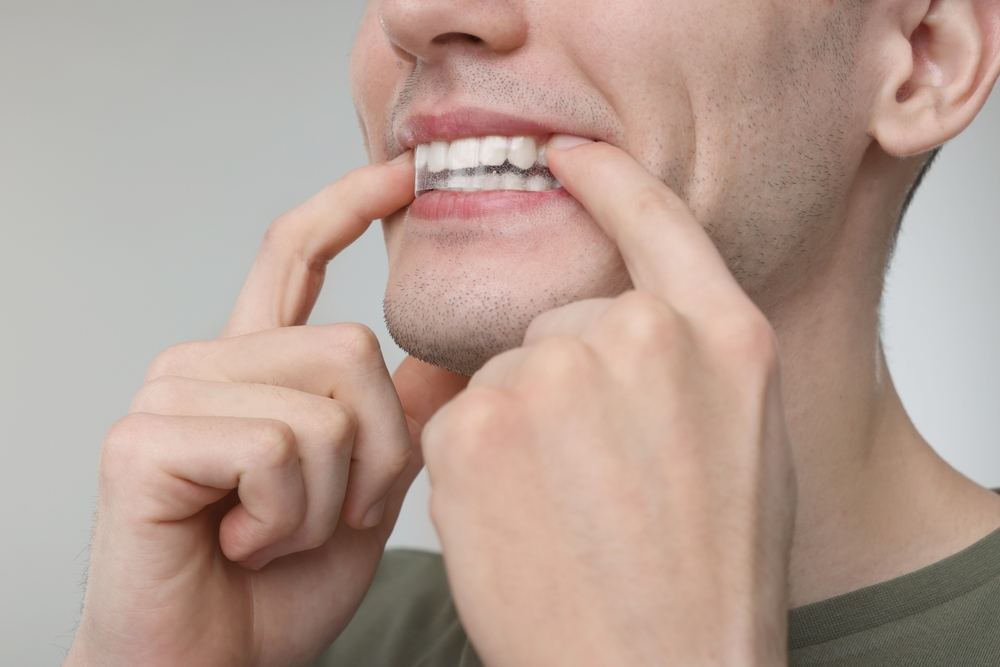 man applying teeth whitening strip